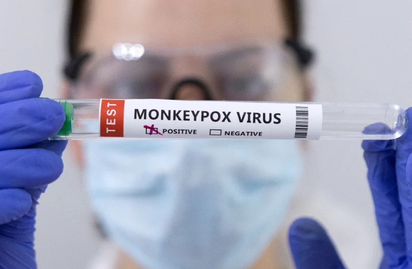Penyakit Monkeypox Di Malaysia : Berhati-hati Dengan Gejala 25 monkeypox img imbd 03 jpg